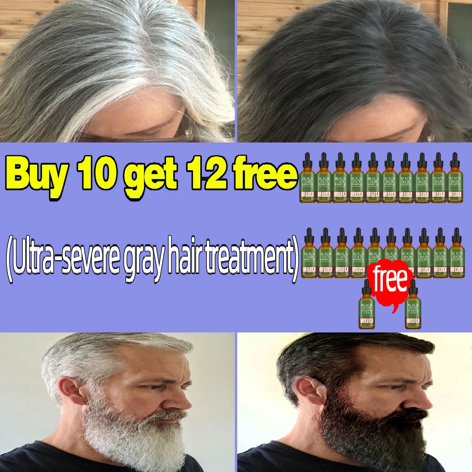 Anti Gray Hair Essence Hair Blackening Serum