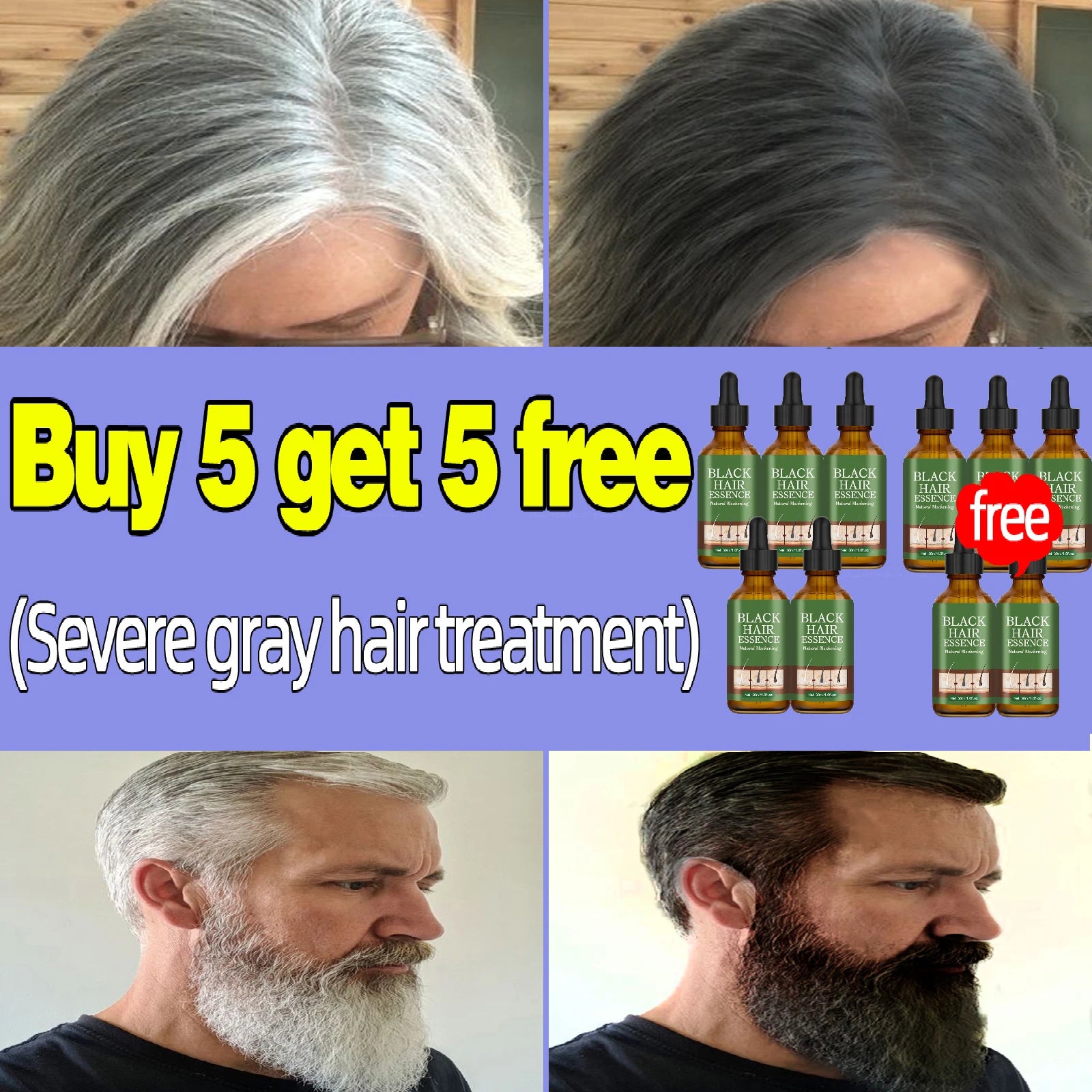 Anti Gray Hair Essence Hair Blackening Serum