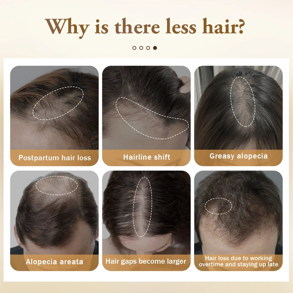 PURC Ginger Hair Growth Products for Men and Women