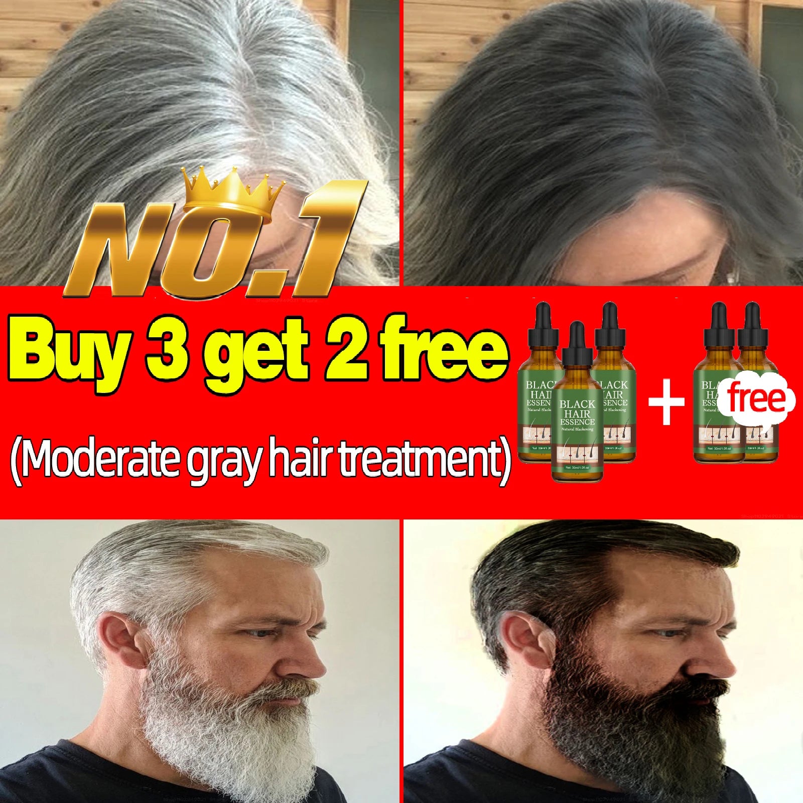 Anti Gray Hair Essence Hair Blackening Serum