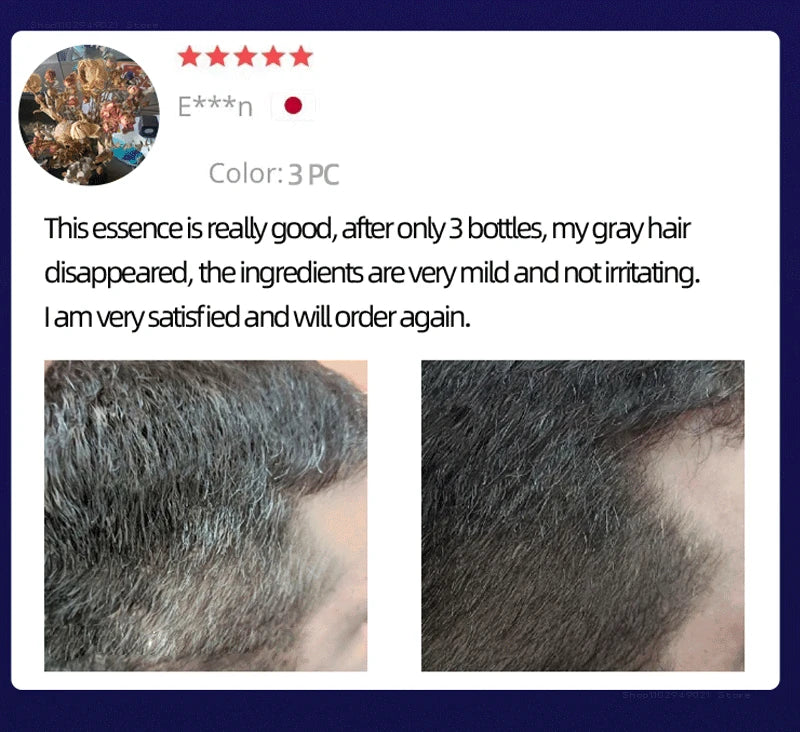 Anti Gray Hair Essence Hair Blackening Serum