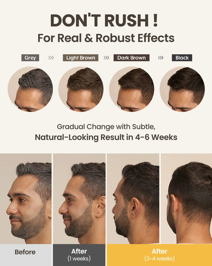 Anti Gray Hair Essence Hair Blackening Serum