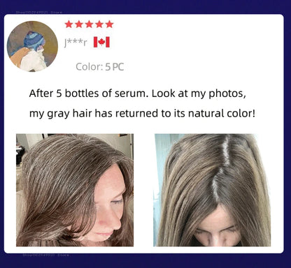 Anti Gray Hair Essence Hair Blackening Serum