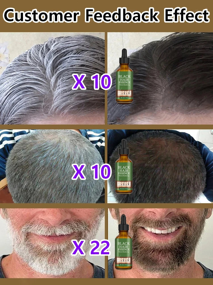 Anti Gray Hair Essence Hair Blackening Serum