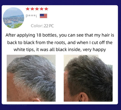 Anti Gray Hair Essence Hair Blackening Serum