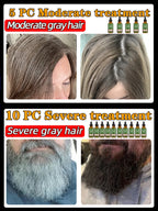 Anti Gray Hair Essence Hair Blackening Serum