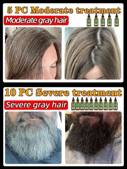 Anti Gray Hair Essence Hair Blackening Serum