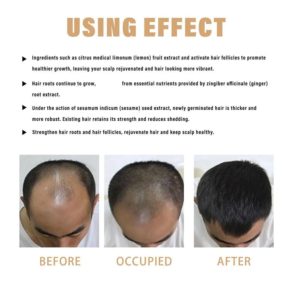 Thickening Shampoo - 100ml for Volumizing & Strengthening All Hair Types