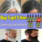Anti Gray Hair Essence Hair Blackening Serum